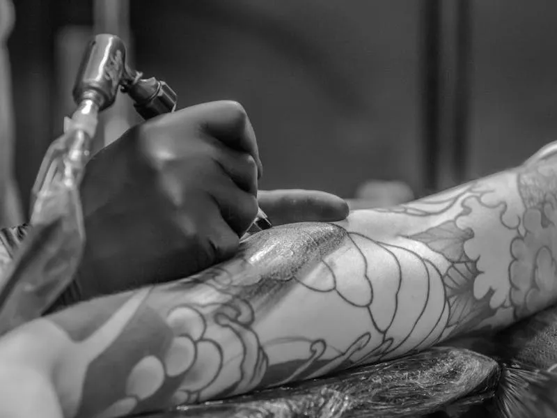 Laser tattoo removal treatment on a client's forearm